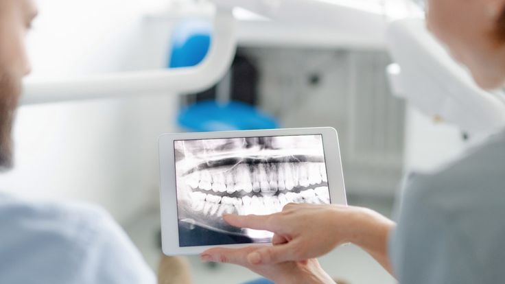 how to stop tooth decay in its tracks